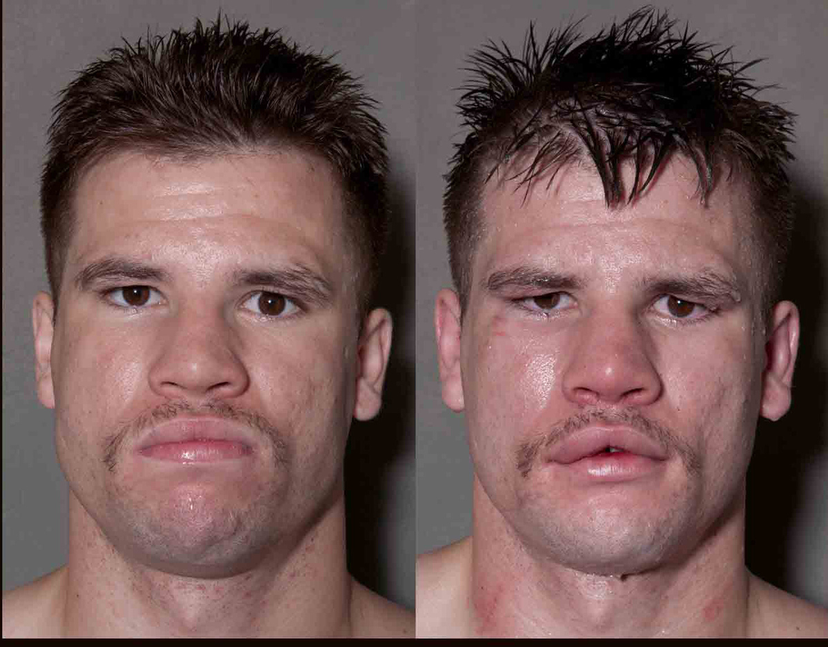 Howard Schatz captura impresionantes retratos de boxeadores antes y