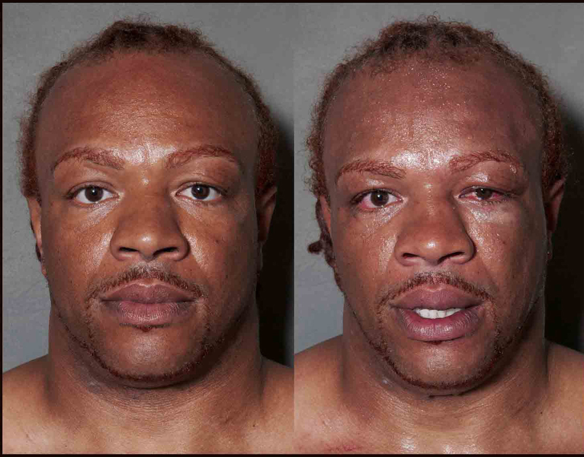 Howard Schatz captura impresionantes retratos de boxeadores antes y